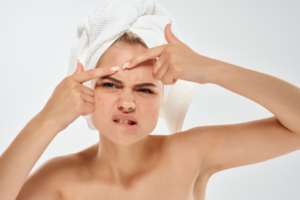 Read more about the article Under Pressure: How Popping Pimples Destroys Dermal Collagen Architecture