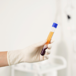 The Regenerative Power Duo: Why We Combine CO2 Lasers with Platelet-Rich Fibrin (PRF)