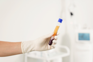 Read more about the article The Regenerative Power Duo: Why We Combine CO2 Lasers with Platelet-Rich Fibrin (PRF)