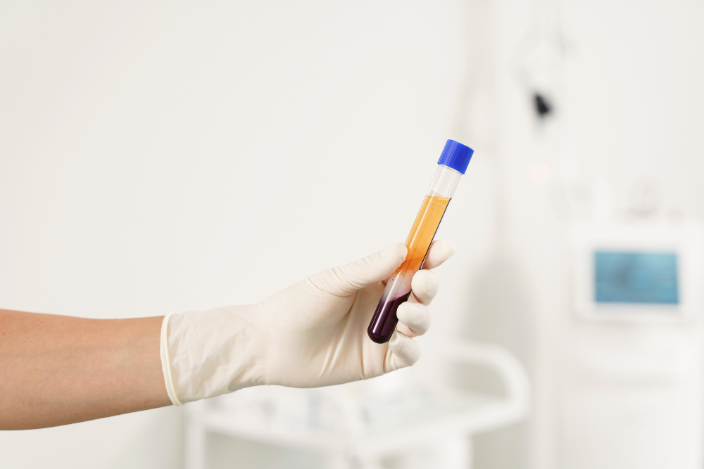 You are currently viewing The Regenerative Power Duo: Why We Combine CO2 Lasers with Platelet-Rich Fibrin (PRF)